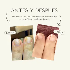SNB Fluido activo Antifungal de uñas con propóleos y aceite de lavanda 15ml - 1 - Cuidado de manos y pies